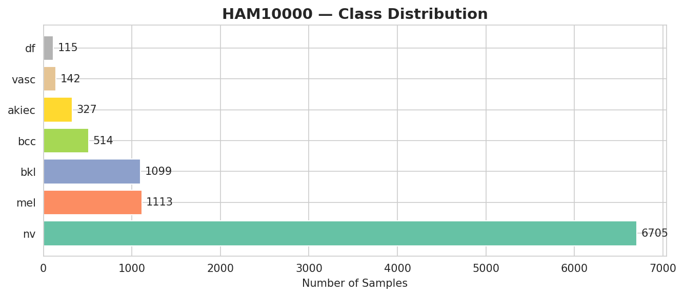 HAM10000 Class Distribution
